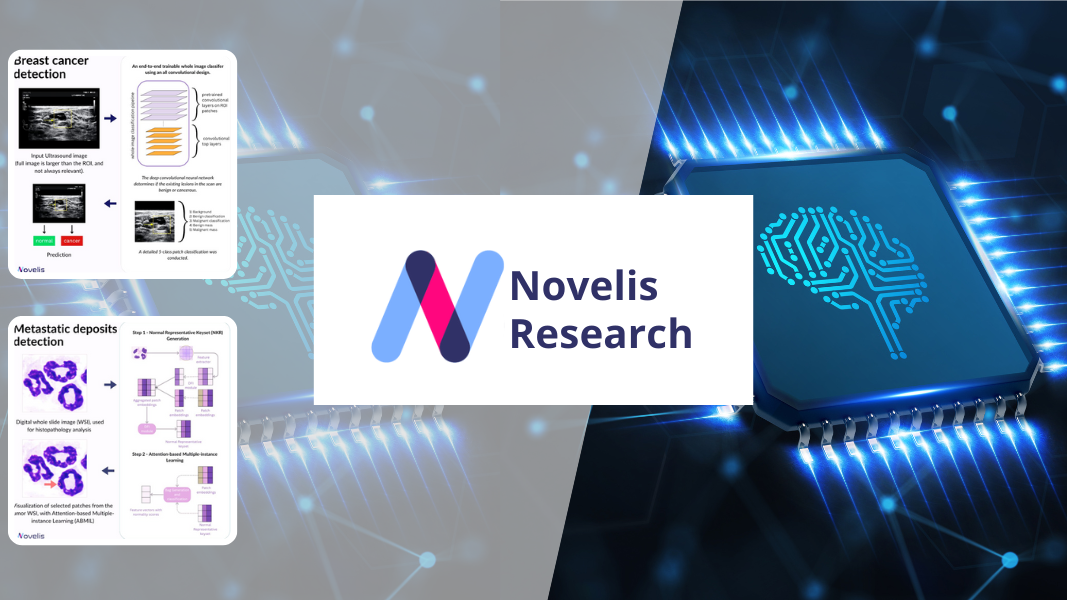 December digest – Summary of our Novelis Research posts on the different ways AI can be used in healthcare